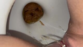 Halfway out already, ScatKings.com Scat Porn 8 ScatKings.com Scat Porn