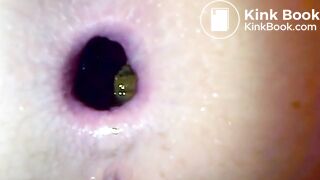 Huge shitty gape, ScatKings.com Scat Porn 3 ScatKings.com Scat Porn