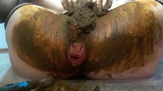 Prolapsed scat.., ScatKings.com Scat Porn 6 ScatKings.com Scat Porn