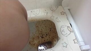 Severe diarrhea - video 6, ScatKings.com Scat Porn 17 ScatKings.com Scat Porn
