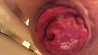 prolapse and shit18, ScatKings.com Scat Porn 12 ScatKings.com Scat Porn
